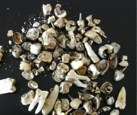 Dentalt skrot